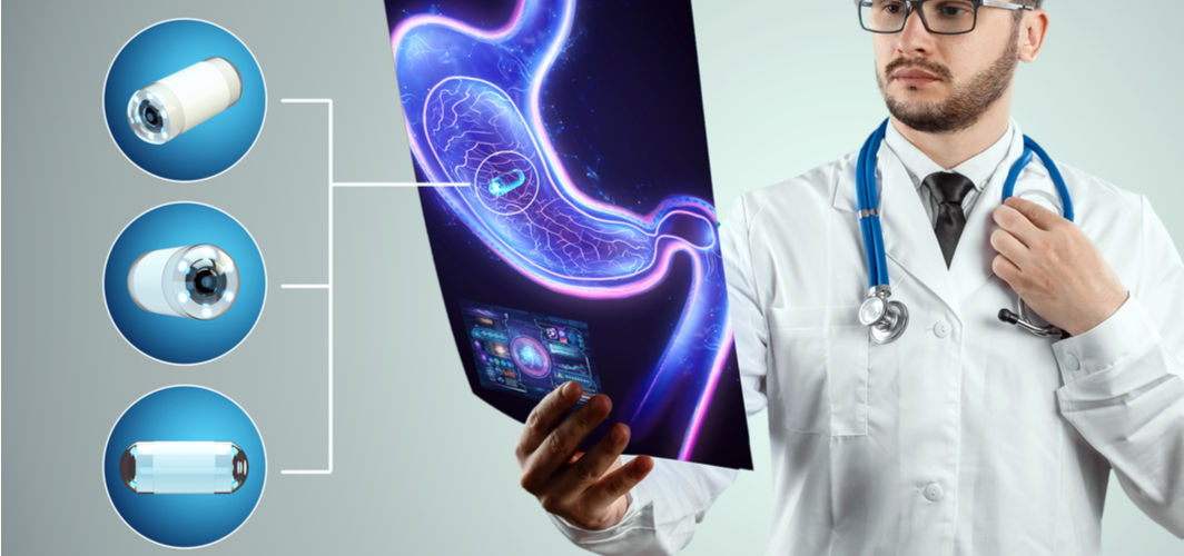 Endoscopy & Colonoscopy How Often Should You Get One Done?