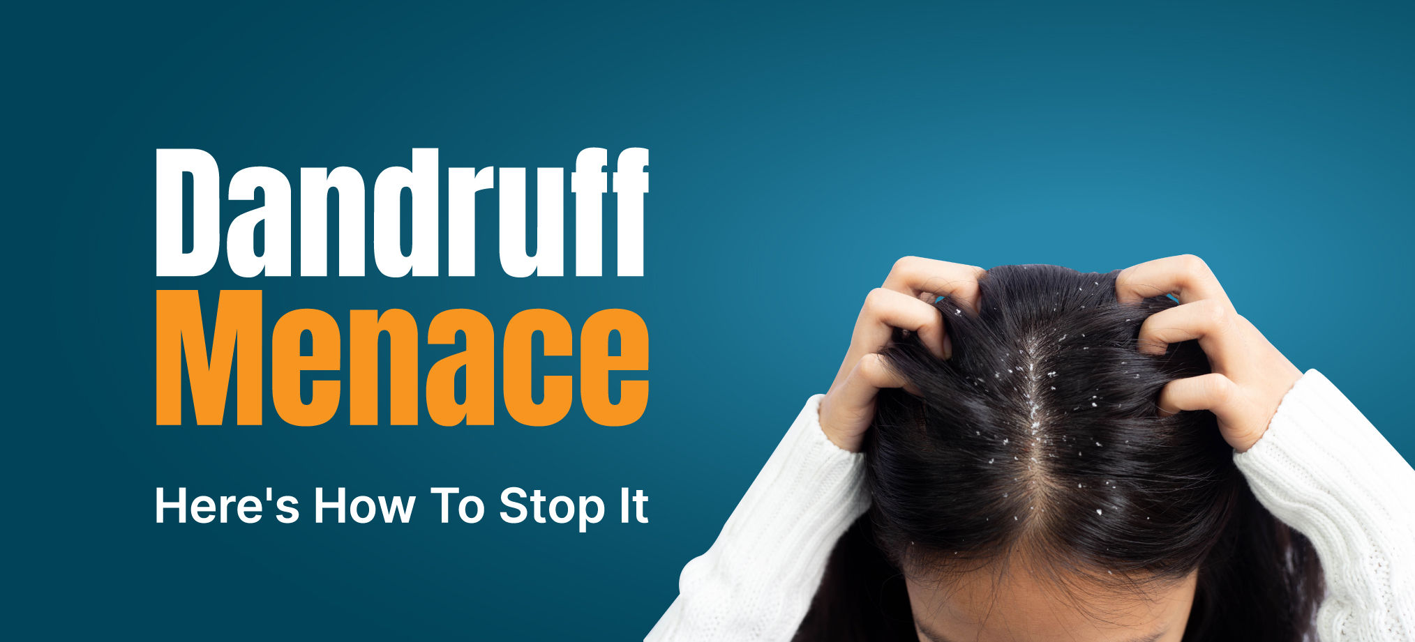 ScientificallyProven Ways To Deal With Dandruff
