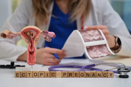artricle image