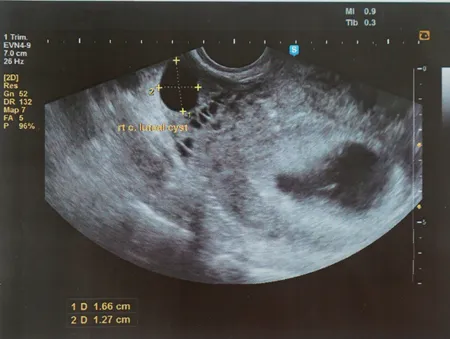 artricle image