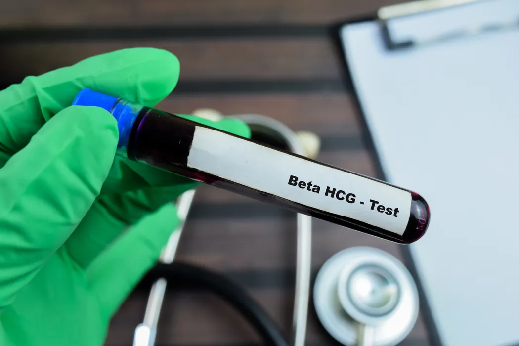 Beta hCG Test: Ranges, Interpretation & Timing Guide
