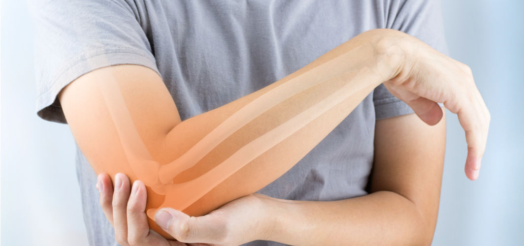 What are hairline fractures?