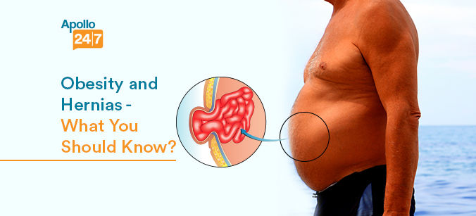 Know About Hernia and Its Connection With Obesity