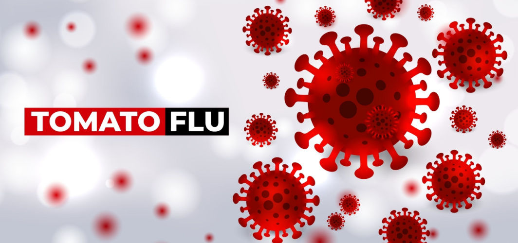 Tomato Flu: From Symptoms to Prevention, Know All About This Disease