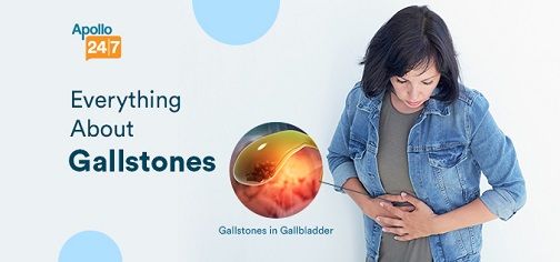 Know about gallstones or gallbladder stones