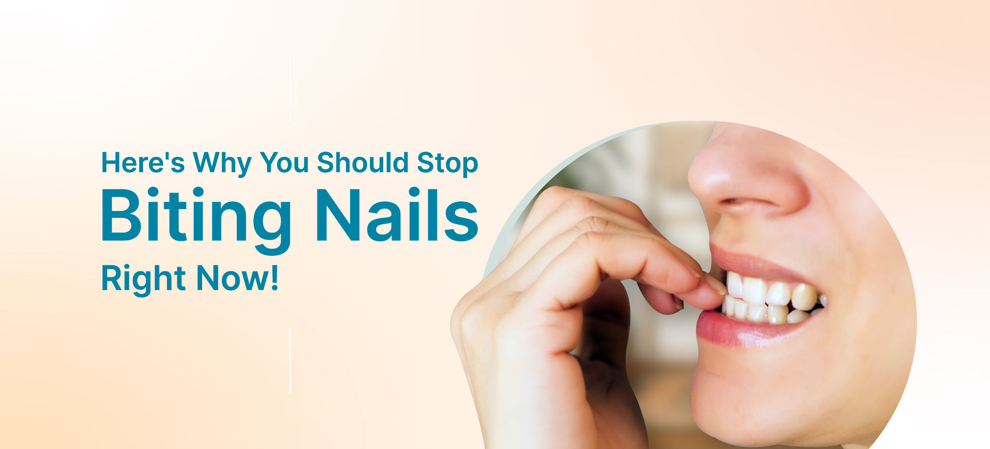 what damages your teeth