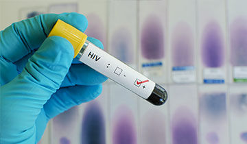 HIV