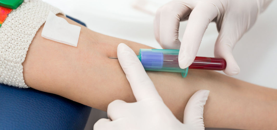 blood sugar test report reading