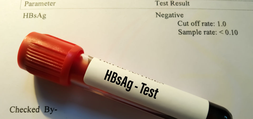 Hepatitis B test