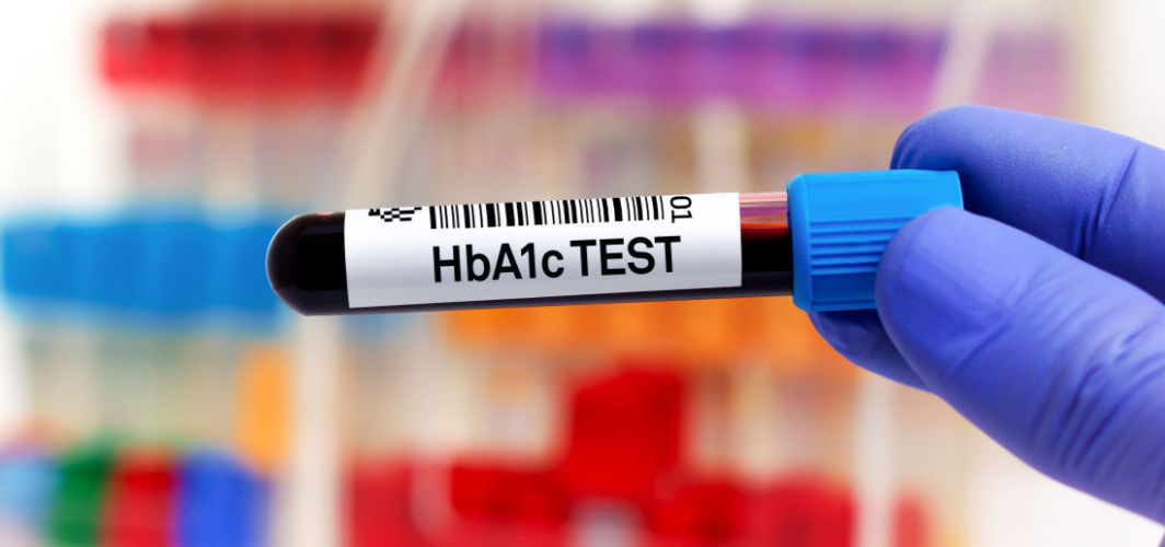 hba1c test