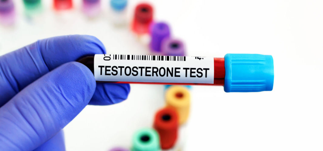 can-you-test-your-testosterone-levels-at-home