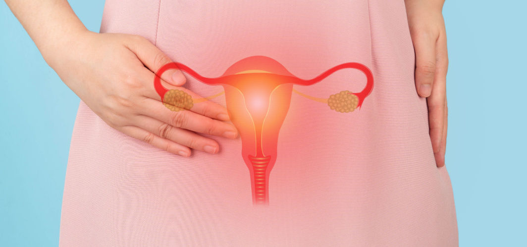 Polycystic Ovary Syndrome In Women