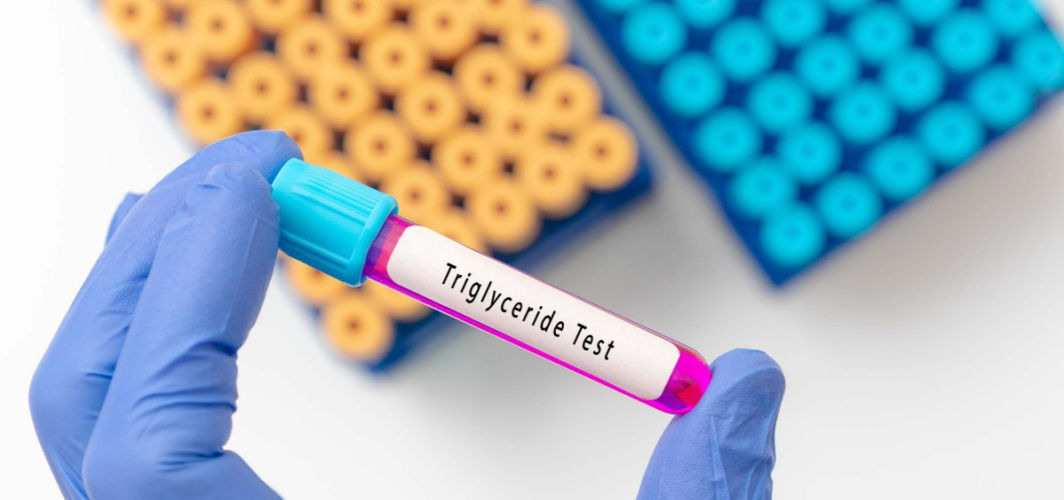 Triglycerides