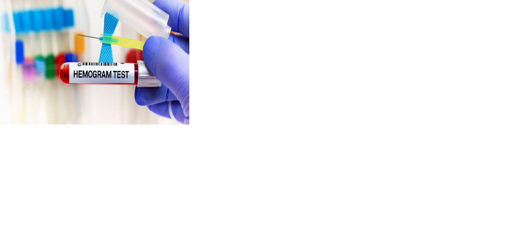 Hemogram Test