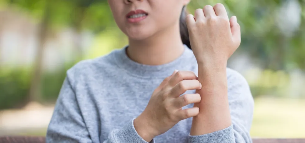 Shutterstock 551851411 0.jpg?tr=q 80,f webp,w 400,dpr 2 Understanding and Managing Winter Skin Diseases: Causes, Treatment and Prevention