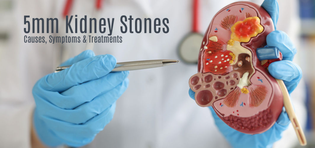 Causes, symptoms and treatments of 5mm kidney stones
