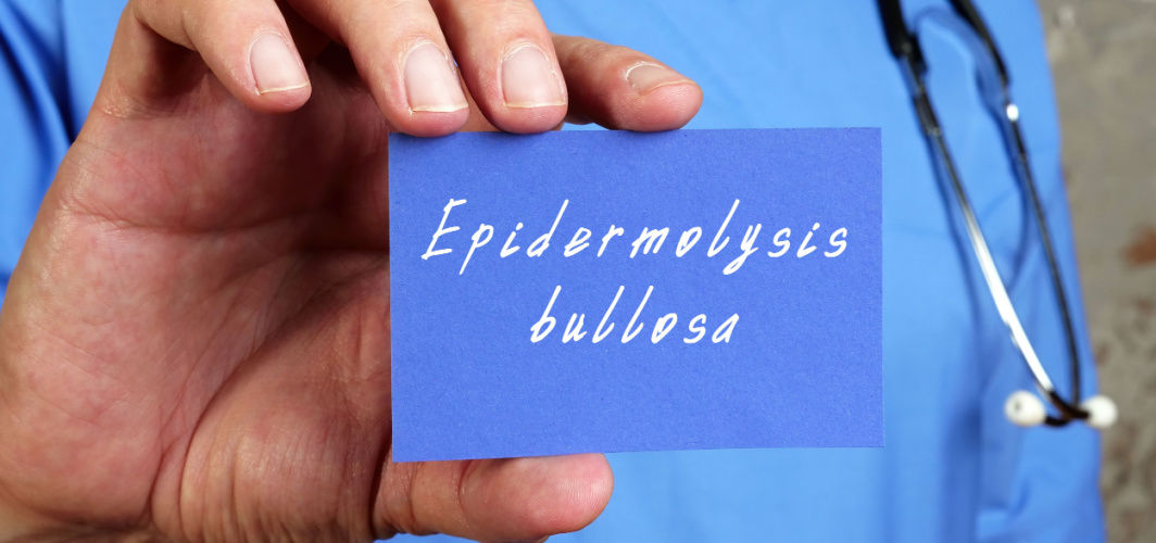Epidermolysis Bullosa (EB): Causes, Symptoms, Treatments & Prevention