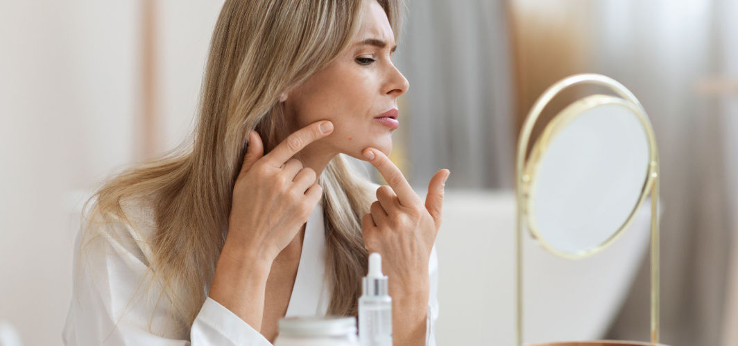 Hormonal Acne Definition Causes Symptoms Treatments And Prevention