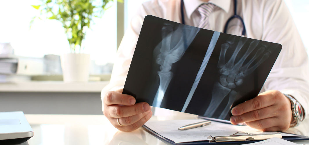 Importance of Bone Mineral Density Test