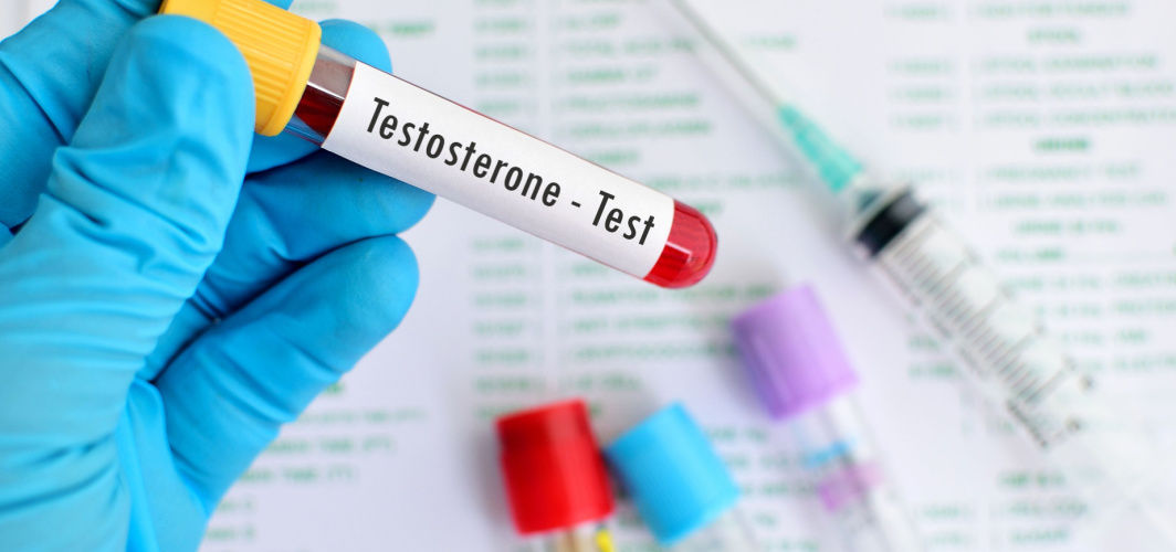 Testosterone Test