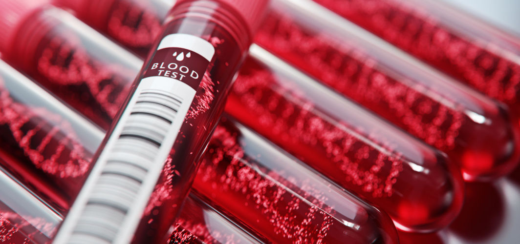 Why is it important to fast before specific blood tests?
