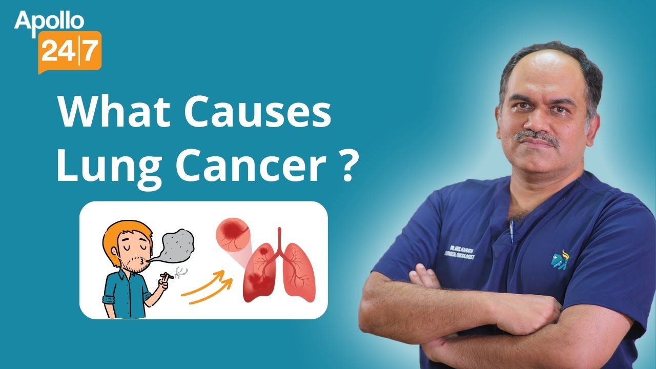 What Causes Lung Cancer?