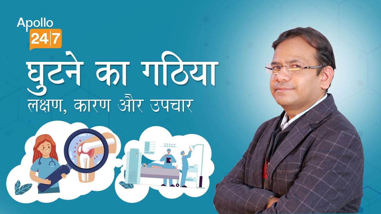 Can Knee Osteoarthritis Go Away On Its Own?