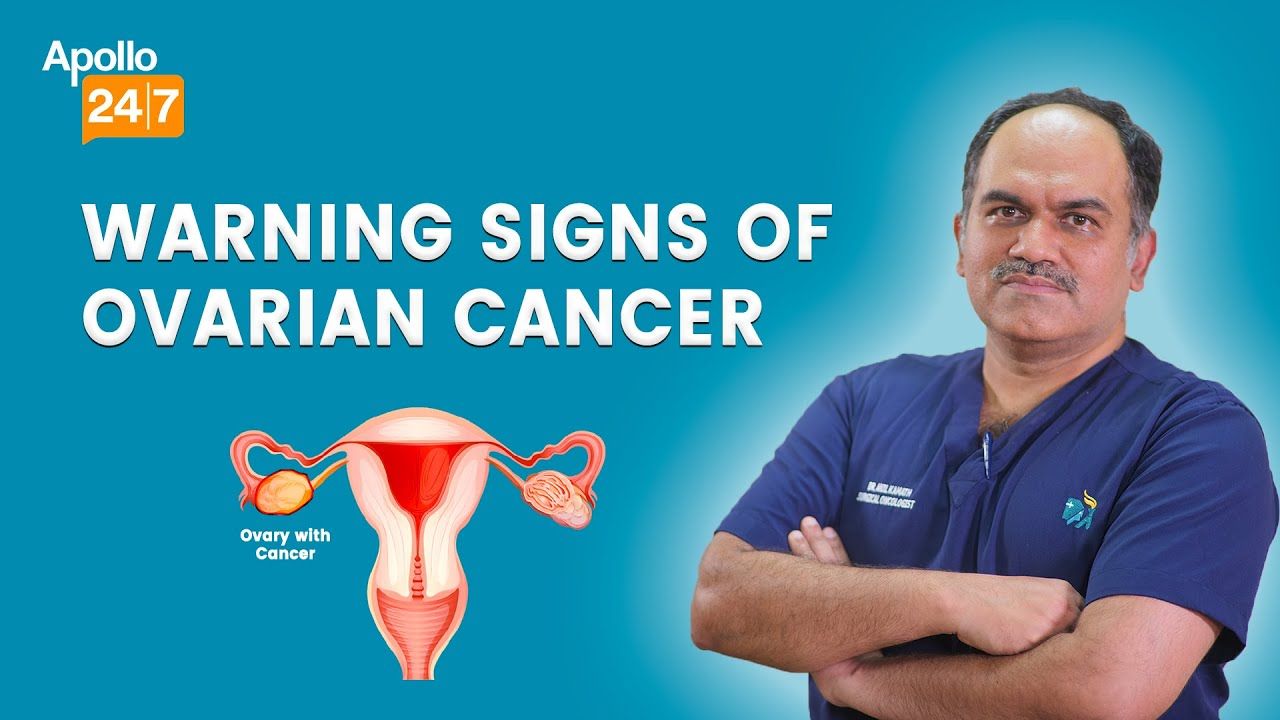 Signs and Symptoms of Ovarian Cancer