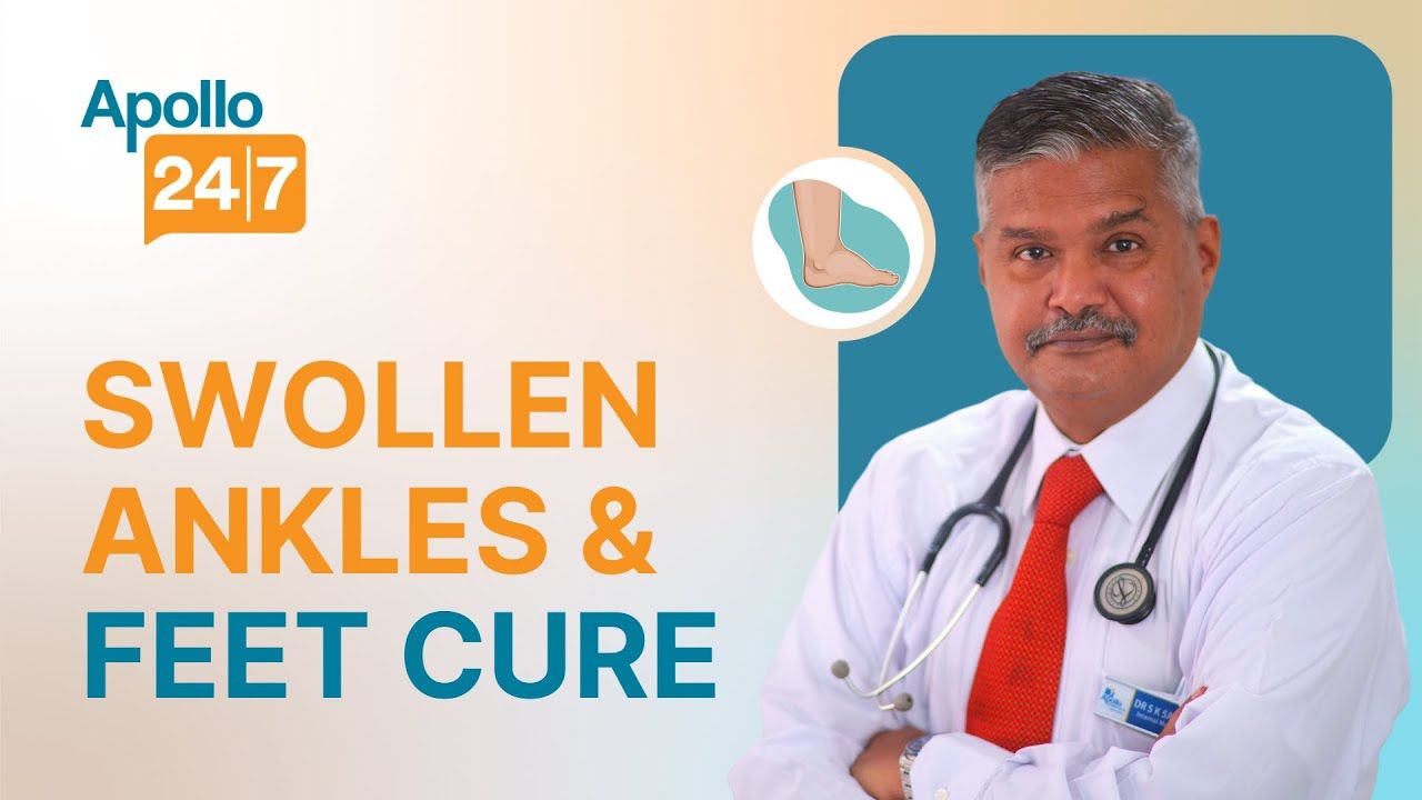 Swollen Ankles & Feet: Causes and Cure?