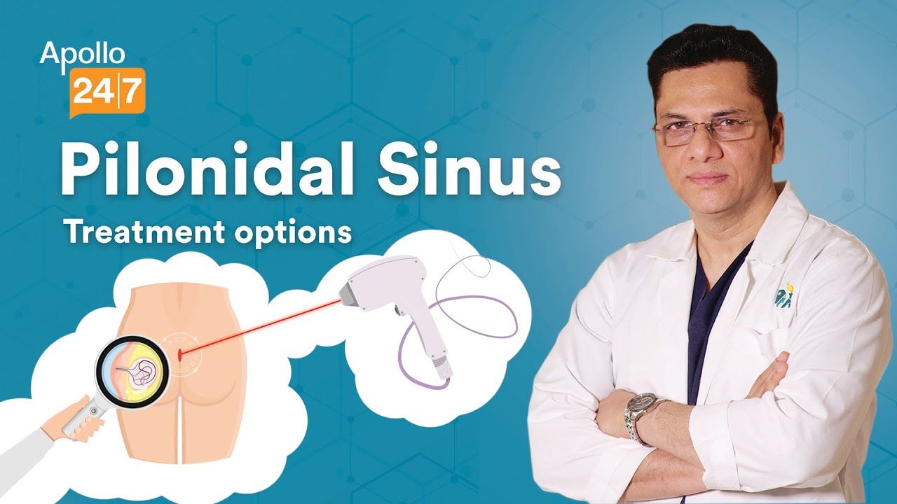 Can Pilonidal Sinus be Treated Without Surgery?