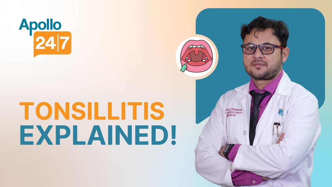 Tonsillitis: What is It, Symptoms, & Treatment