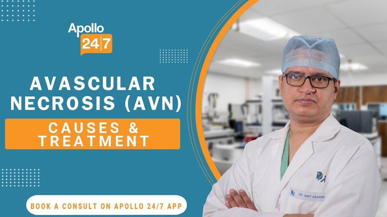 Avascular Necrosis (AVN) Causes & Treatment
