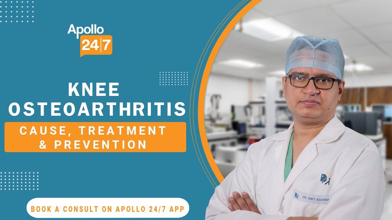 Knee Osteoarthritis: Cause, Treatment & Prevention