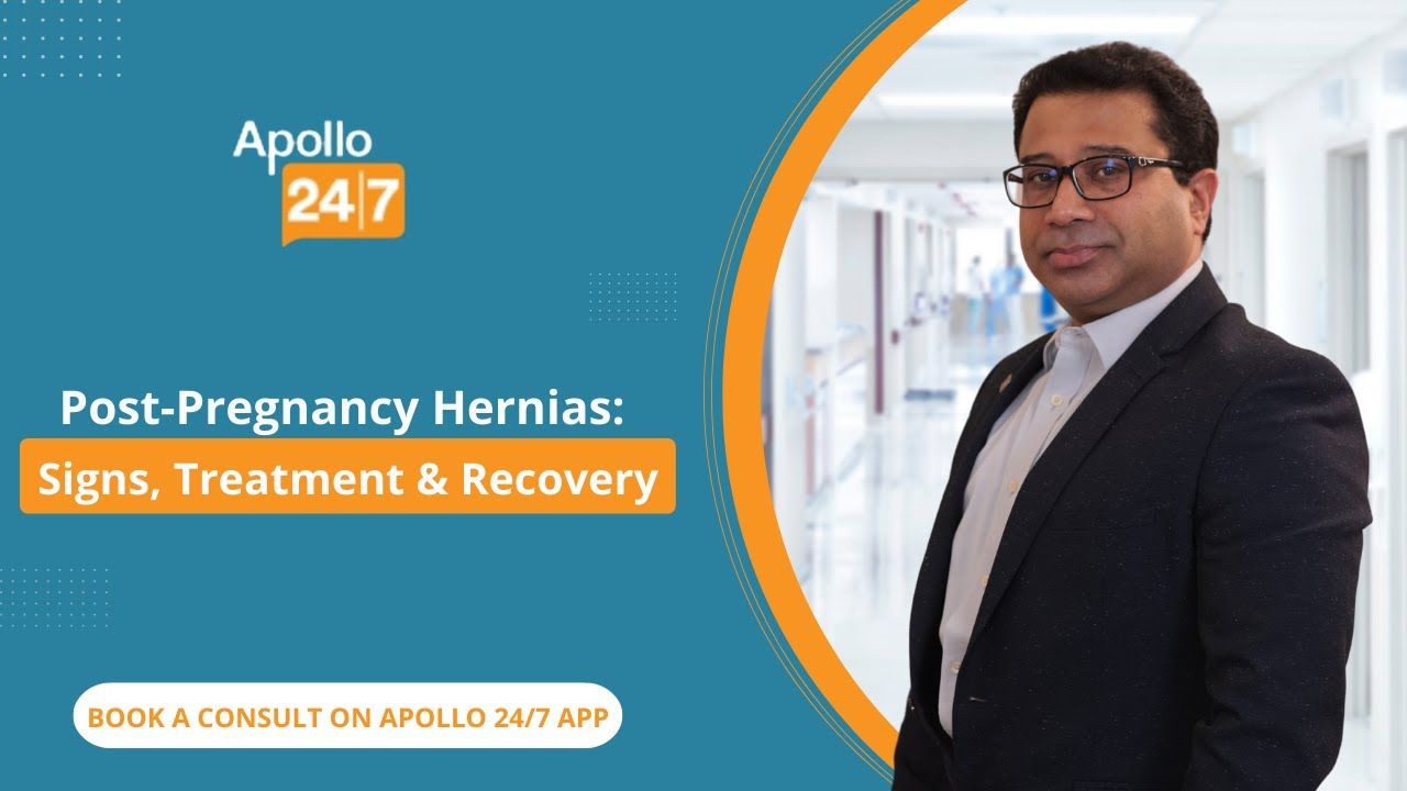 Post-pregnancy Hernias