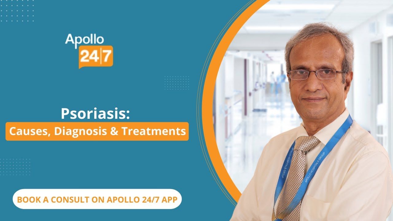 How Do You Treat Patchy Dry Skin (Psoriasis)?