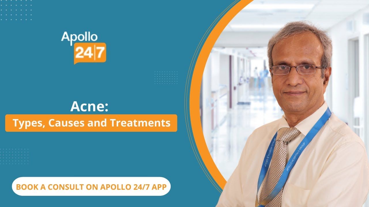 How To Treat Acne Scars?