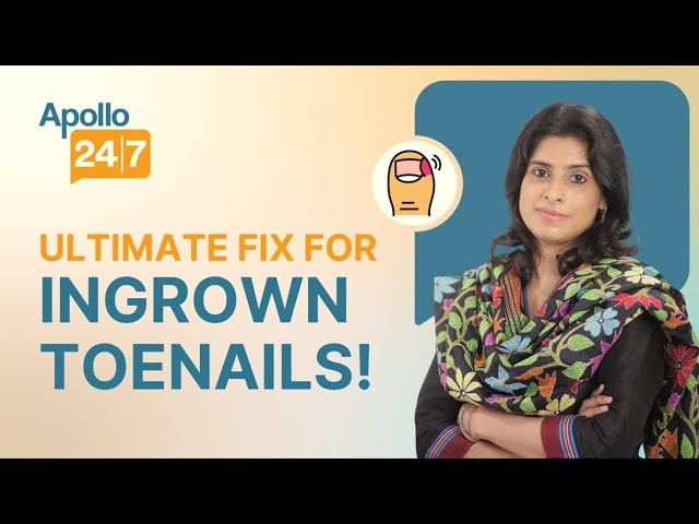 How to Fix Ingrown Toenail