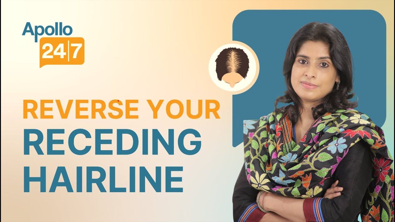 Can You Reverse a Receding Hairline