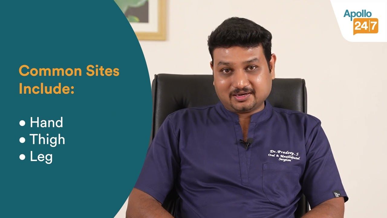 Oral Cancer Treatment Guide: Diagnosis, Surgery, Recovery | Dr. Pradeep. S | Apollo 24|7