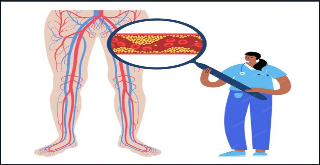 What Are The Microvascular Complications Of Diabetes?
