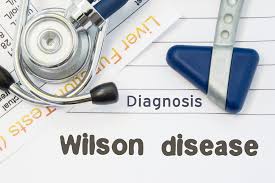 Wilson's disease