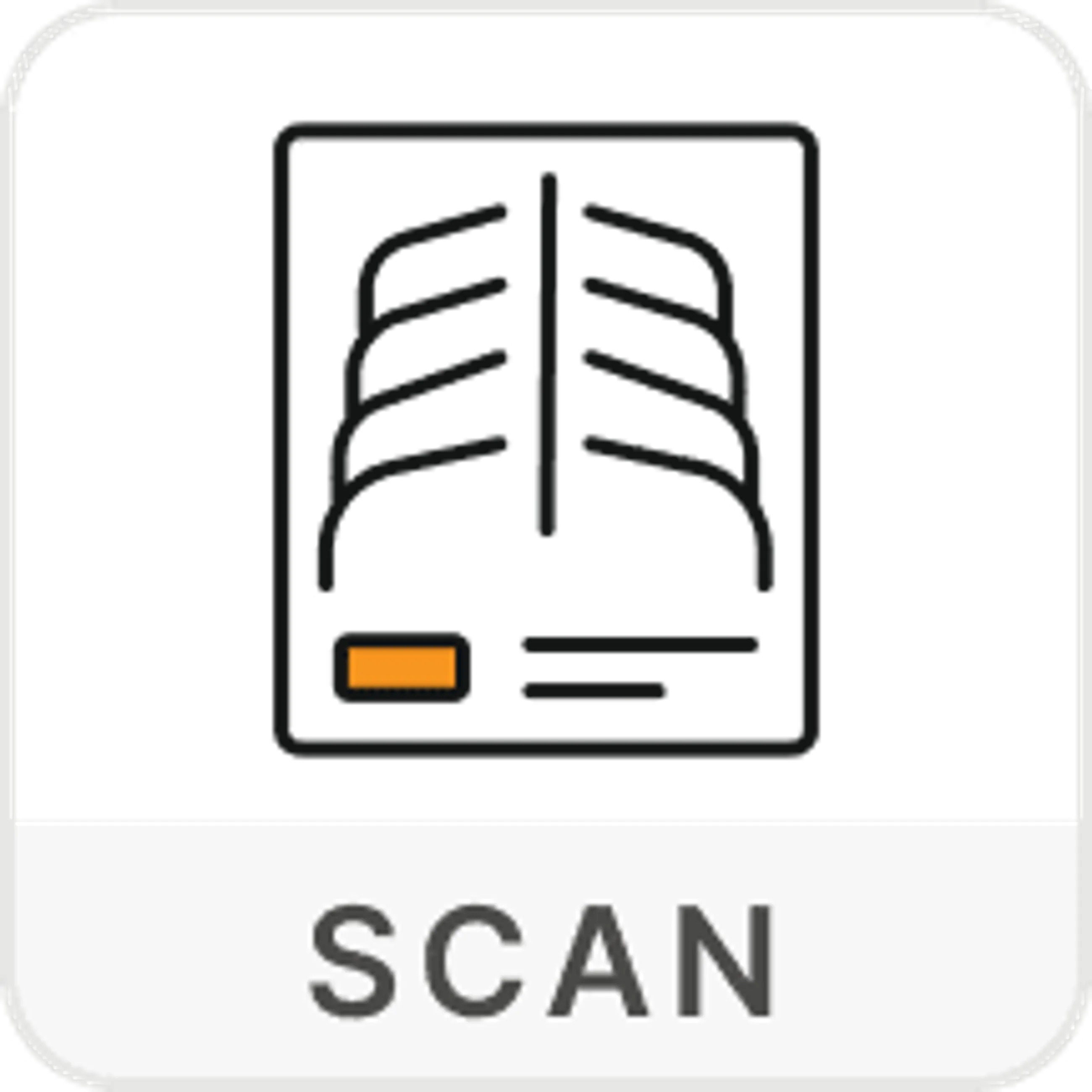 DEXA SCAN (BONE DENSITY) - HIP AND SPINE