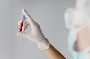 CRP Test normal range