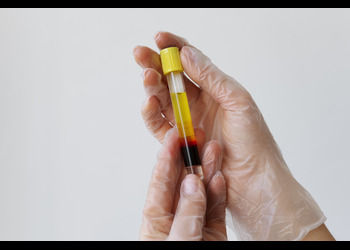 Know Normal Ranges and Health Implications