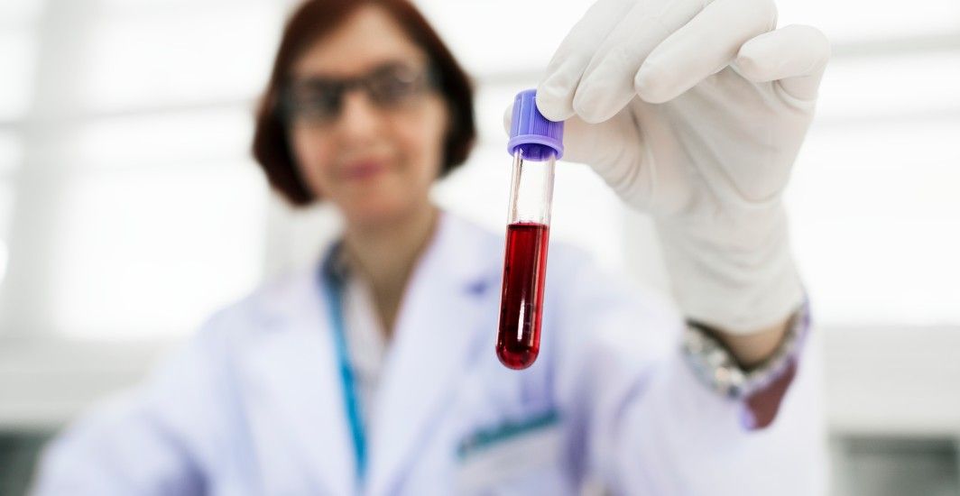 RBC Test - Normal Range, Purpose, Procedure And Results Interpretation