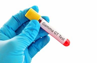 Gamma-glutamyl Transferase (GGT) Test