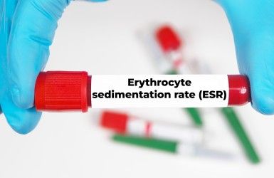 ESR Test