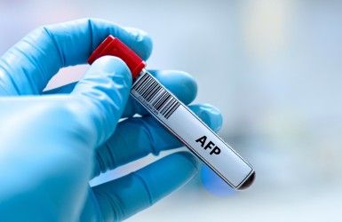 AFP Test