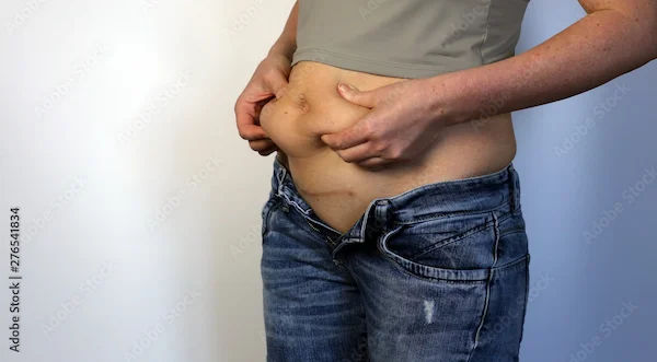 How to Reduce Weight After C-Section?