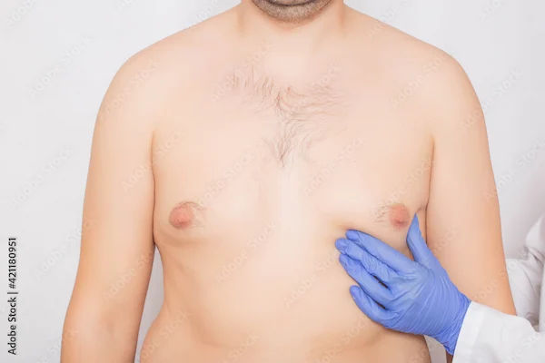 How To Reduce Breast Fat?